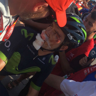 Carlos Betancur se retira de la Vuelta a España, por fractura de Tobillo